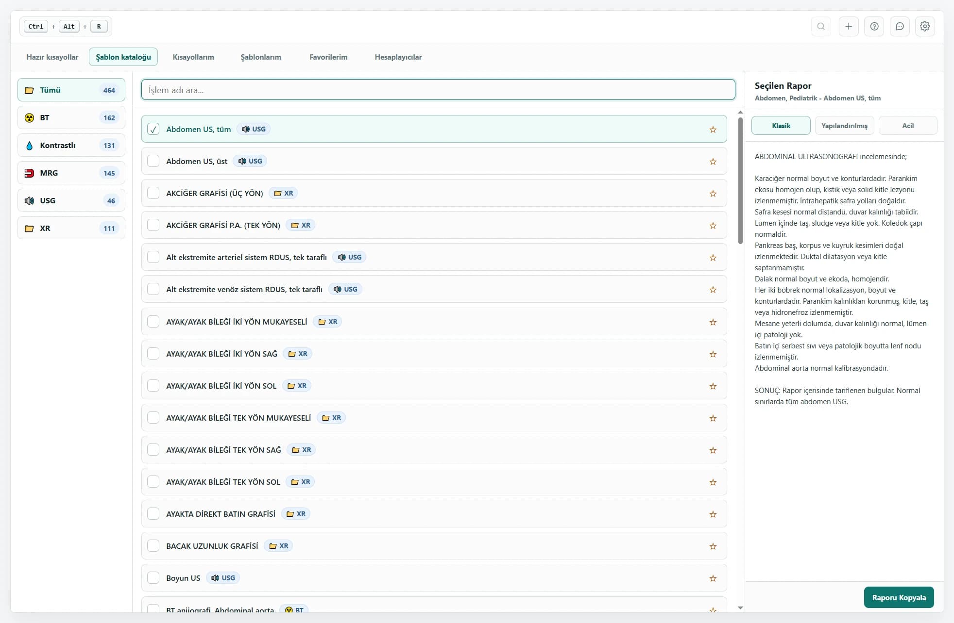 RadPhrases report overlay with modality filters, a searchable template list, report variants, and a selected report preview